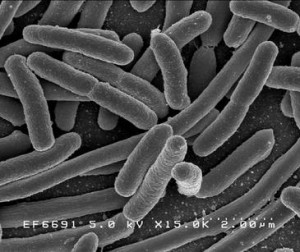 Escherichia coli, una de las muchas especies de bacterias presentes en el intestino humano. Imagen: Wikipedia