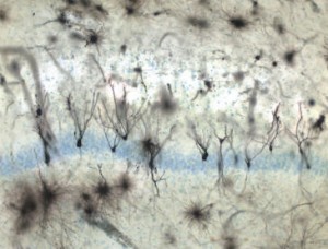 neuronas granulares-imagen-sinc