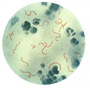 bacteria  Streptococcus pyogenes. / Wikipedia